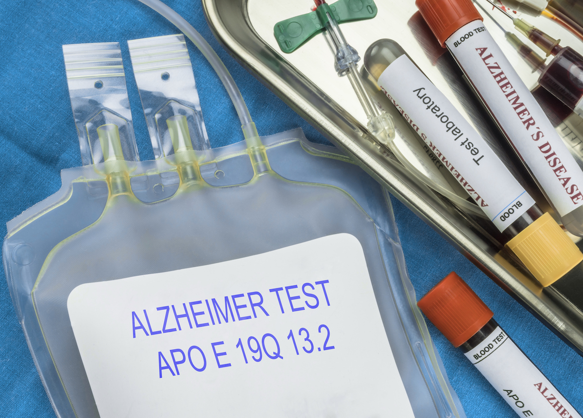 Prepare for Alzheimer's care